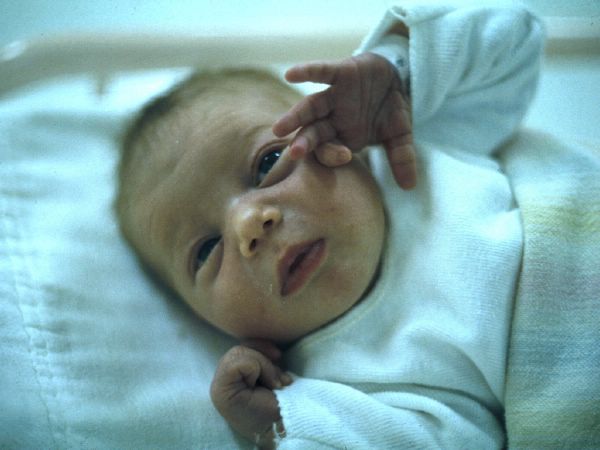 Anita in Beaumont Hospital